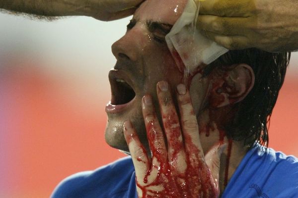 意大利铁卫铁腰激烈拦截,帮助球队稳住场面!的简单介绍 意大利铁卫铁腰激烈拦截,帮助球队稳住场面!的简单介绍